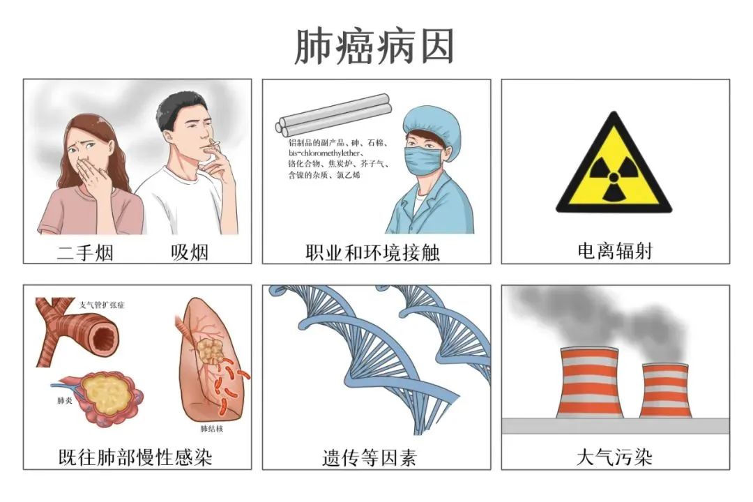 肺癌的15个征兆癌症图片